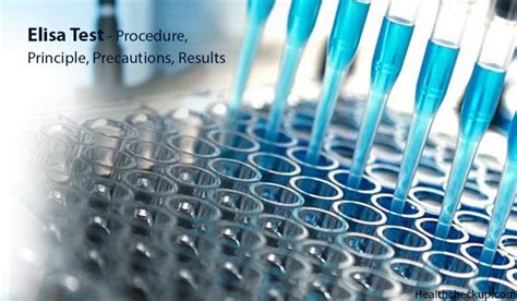 ELISA Test Procedure, Preparation, Results .